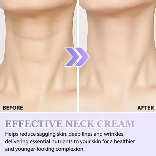 Crema For El Cuello, Crema Hidratante For El Cuello