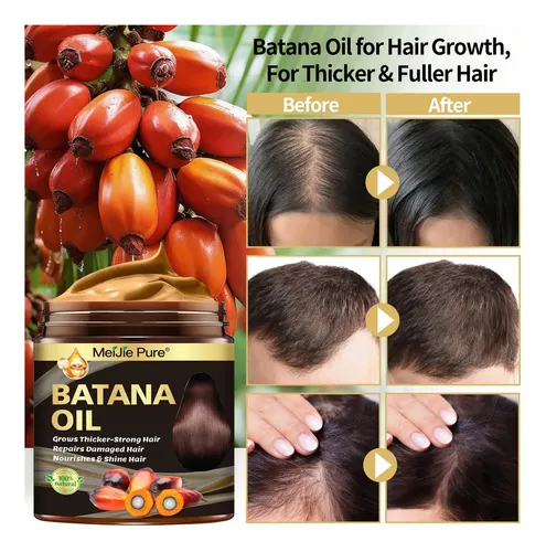 Set Aceite Batana Cuidado Capilar Mascarilla 4 Unidades