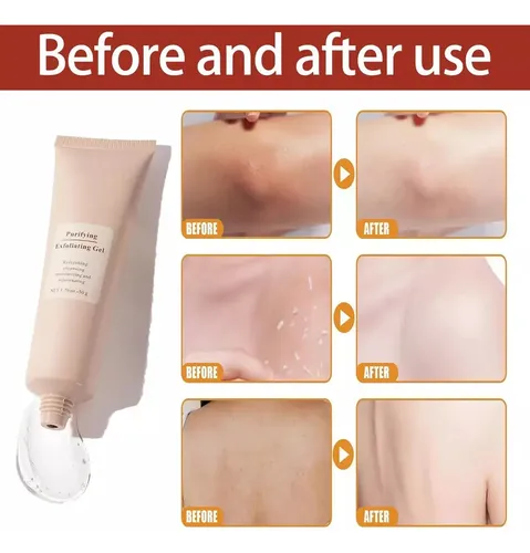 Agel Exfoliante Purificante Jorondy, Gel Exfoliante Jorondy