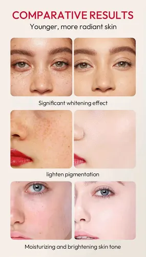 Txa+niacinm Brighen Seru For Dul Skin  Dark Spot Reduc 30ml