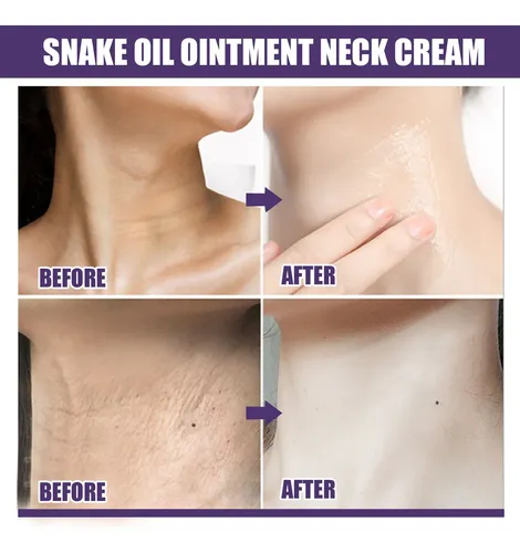 Crema Avanzada Para El Cuello Que Decolora Y Deja Líneas De
