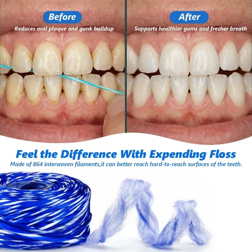 Hilo Dental Encerado Expandible Menta 10 Carretes 30 M