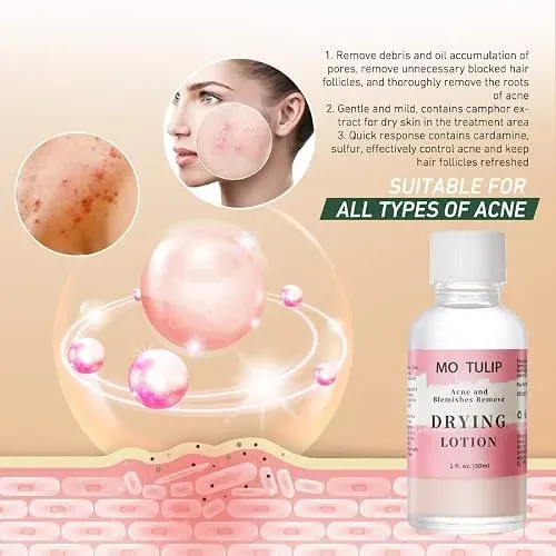 Locion Secante Acne Yuzamour Mo Tulip New Drying