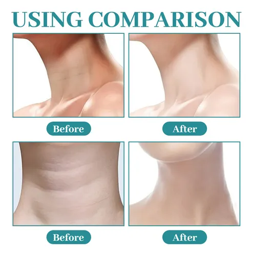 Crema Hidratante Reafirmante Para Cuello, Pecho, Brazos Y Pi