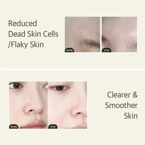 Mixsoon Bean Essence Hidratante Exfoliante 50ml