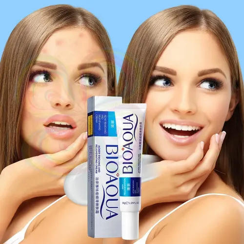Crema Facial Para Puntos Negros, Antiacné, Cicatrices Y Poro