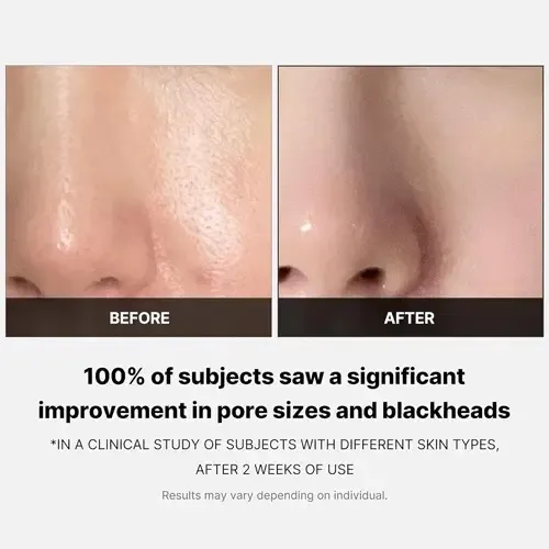 Discos Exfoliantes Para Poros Zero Pore Pad 2.0 Medicube