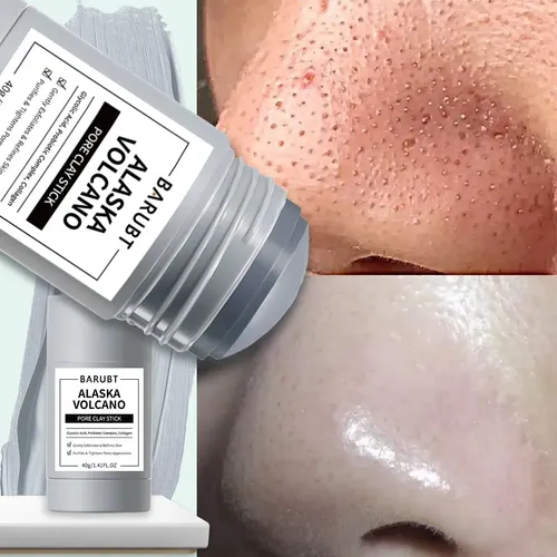 Mascarilla Facial En Barra Arcilla Poros 40 G