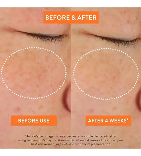 Crema Carotone B.s.c Corrector De Manchas 30 Ml Todo Tipo De Piel Día/noche