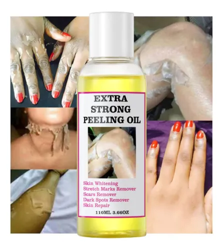 Aceite Exfoliante Amarillo Extra Fuerte 220 Ml Para Todo Tip