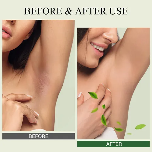Exfoliante Desintoxicante Para Axilas Shvyog Green Tea Con M