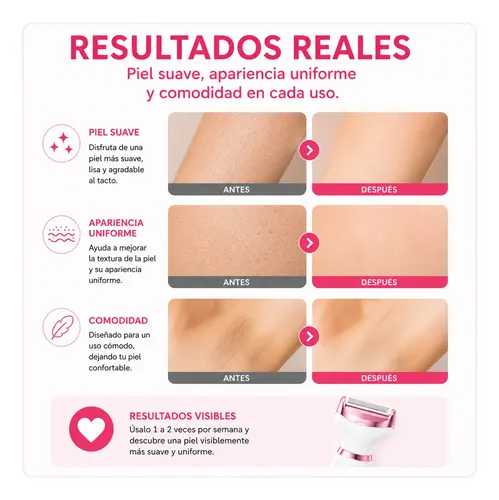 Depiladora Eléctrica Portátil Usb 4 En 1 Facial Corporal