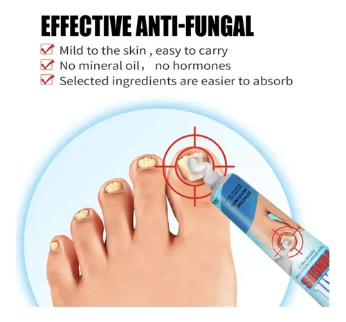 Crema Anti Hongos De Uñas Ataca Onicomicosis Pies Salud Fragancia Herbal