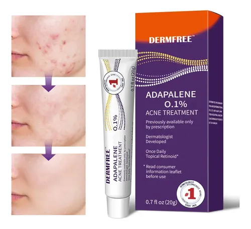 El Antiacné Facial Contiene Adapaleno Para Pieles Con Acné Z