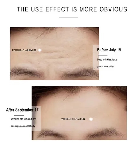 Crema Facial Con Colágeno Y Retinol, Líneas Suaves Y Finas,  Todo Tipo De Piel Día/noche
