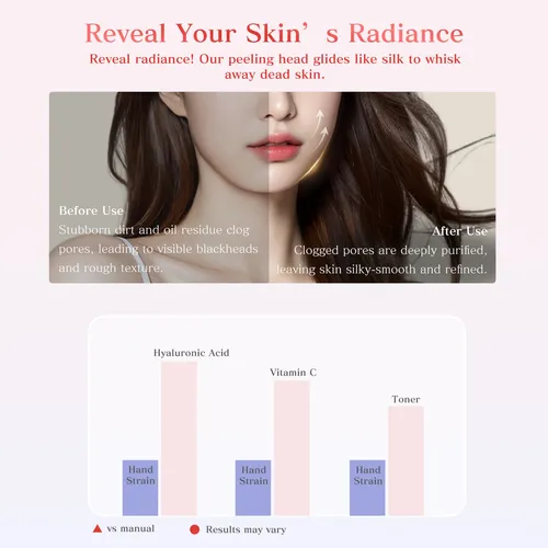 Maxgrooultrasonic Skin Blackhead De Peeling Remover Tcv