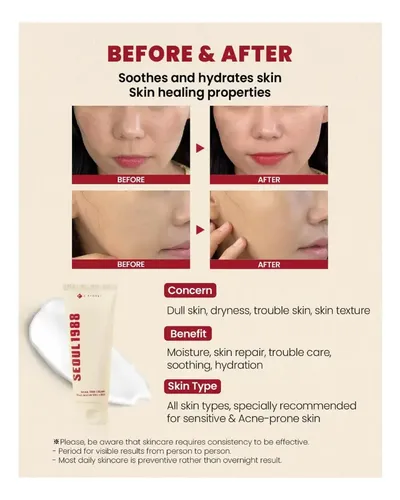 KSECRET Seoul Crema Mucina Caracol 93% y Arroz Hipoalergénica 100ml Facial