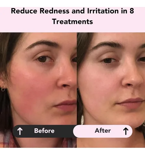 Mascarilla De Arcilla Calm De Glorio (8 Tratamientos)