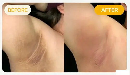 2026 Crema Iluminadora De Manchas Oscuras Adeus (100 G)