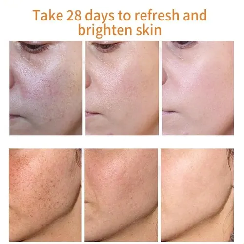 Crema Hidratante Para Manchas Que Se Decoloran, Nutre Y Mejo Todo Tipo De Piel