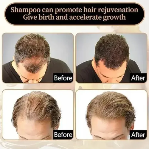 (nuevo) Spartan Shampoo 2024, 5 Botellas, Activador De
