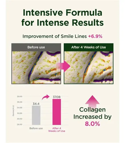 Crema Facial Para El Acné Retino Colágeno Antiedad