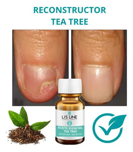 Reconsctructor Uñas Con Hongos Tea Tree Lis Line 10cc