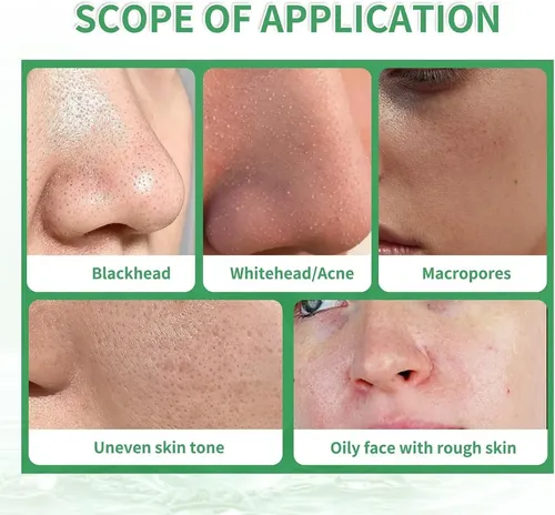 Mascarilla De Arcilla Facial, Verde Tomato For Zxc