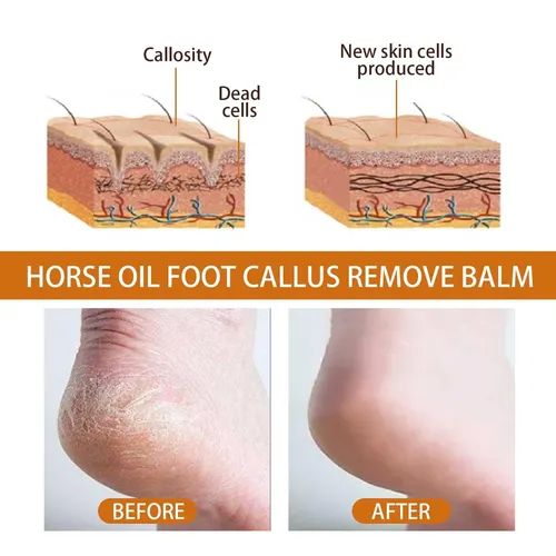 La Crema Para El Cuidado De Los Pies Ouhoe Con Aceite De Cab