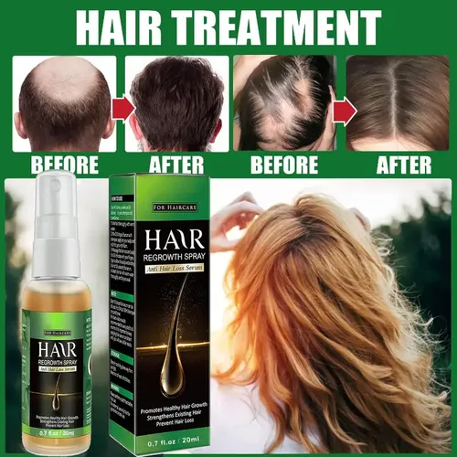W El Sérum Para El Crecimiento Del Cabello Promueve El W
