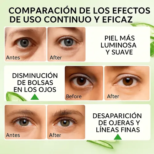 Parches Para Ojeras Lanbena Aloe Vera Hydra-gel 60u Todo Tipo De Piel