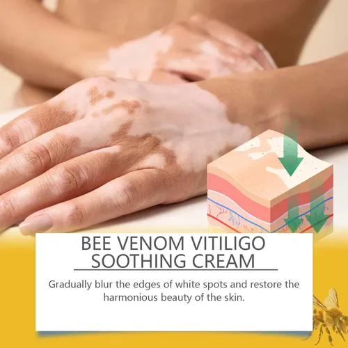 Crema Para El Cuidado De La Piel Para Manos, Pies Y Cuerpo,