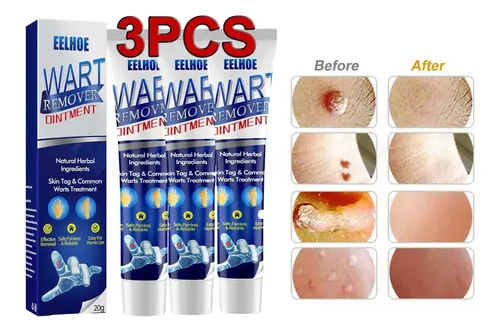 Crema Para La Eliminación Instantánea De Manchas Removedor