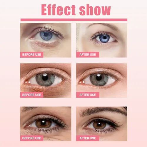 = Bálsamo De Ojos De Rosa Mosqueta 3g – Anti-ojeras Y -/