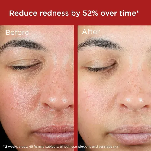 Protector Solar Facial Eltamd Spf 50 Con Óxido De Zinc