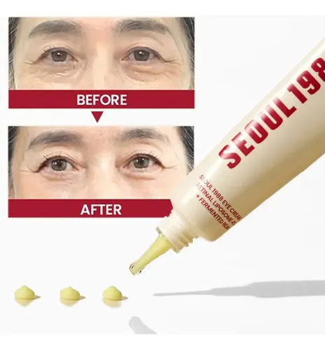 [rx Crema De Ojos Seoul 1988 Con Retinol, 30 Ml
