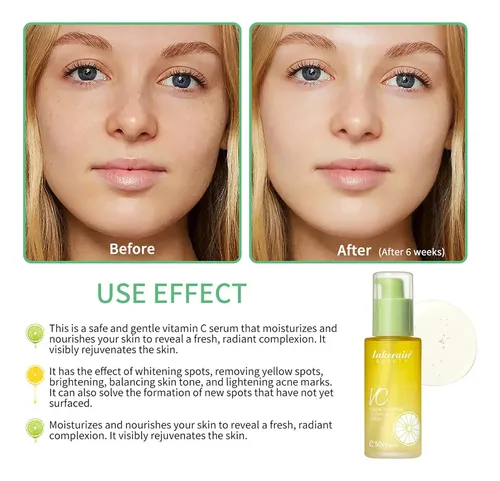 Sérum Facial Vitamina C Mandarina Verde Niceface 50ml