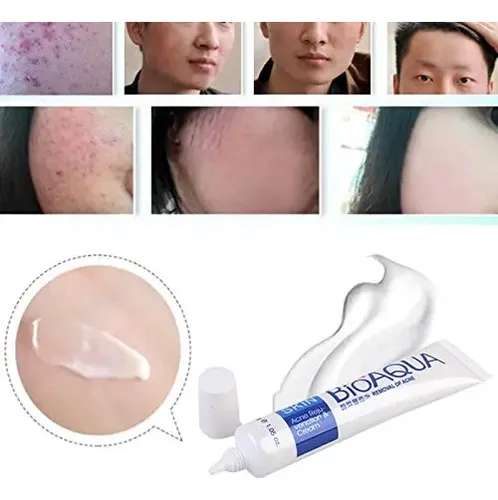 Crema Oleosa 3 En 1 Para Eliminar Las Cicatrices Del Acné F