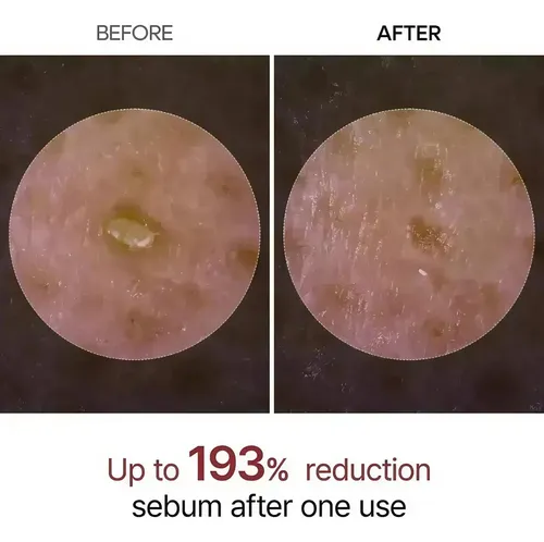 Sdfs Exfoliante Dr. Melaxin: Cuerpo, Eliminador De Werw