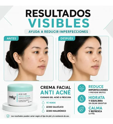 Crema Facial Mely Acne Care Ácido Salicílico Té Verde 50g Acneica Día/noche