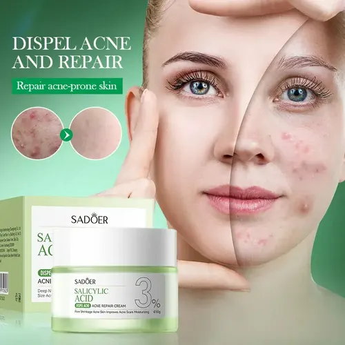 Crema Facial De Ácido Salicílico Acne Piel Grasa Sadoer