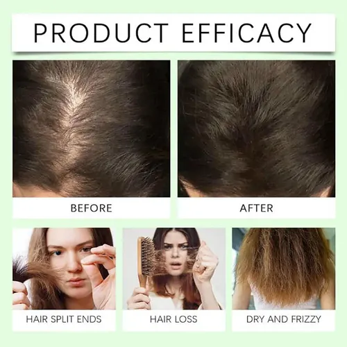 . Champú Remimpi Contra La Caída Del Cabello Que Promueve