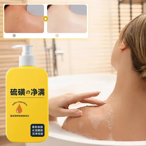 Gel Limpiador Y Eliminador Suave Que Puede Causar Cada Baño