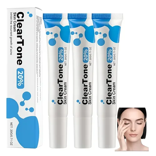 Crema Facial Para El Acné Con Un 20% De Ácido Azelaico,