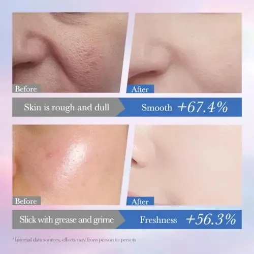 Limpiador Facial Niacinamida 10% Arbutin Blanqueador 100 Ml