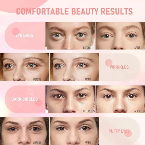 Lavone Parches Ojos Rosa 30 Pares, Anti-edad, Ácido