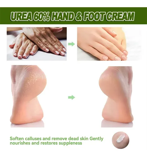 Crema De Urea Máxima Fuerza Para Pies