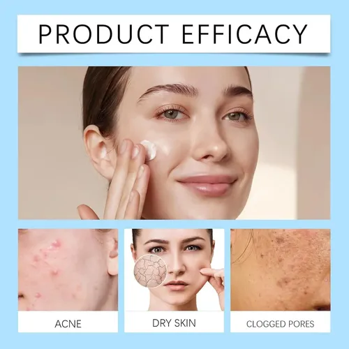 Crema Facial Para Acné Con 20% De Ácido Azelaico, Sérum De Á