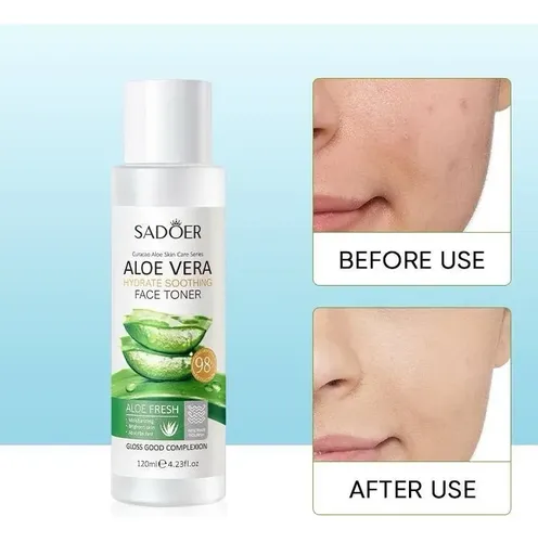 Tónico Facial Aloe Vera Hidratante Reparador 120 Ml Sadoer