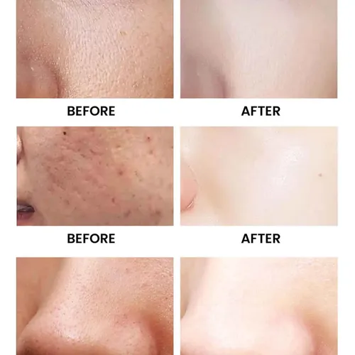 Jabón Facial Y Corporal Hidratante, Creativo, Calmante Y